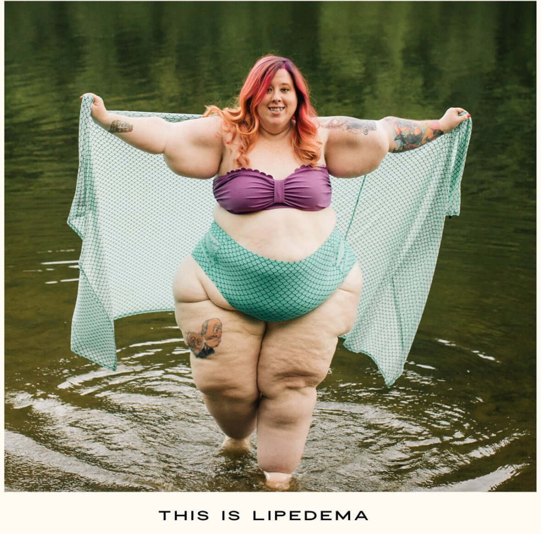 LIPOELASTIC Canada -♡ Understanding compression class II - interview with Cara Cruz (@palegingerpear) 